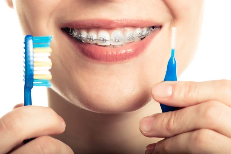 Keeping Your Gums Healthy With Braces Orthodontic Center of Santa